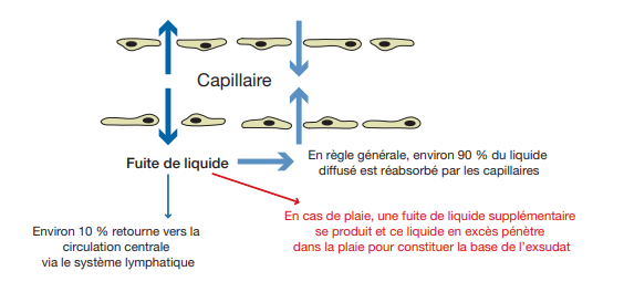 les plaies exsudatives